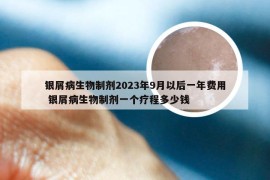 银屑病生物制剂2023年9月以后一年费用 银屑病生物制剂一个疗程多少钱