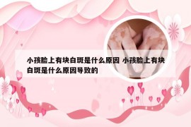 小孩脸上有块白斑是什么原因 小孩脸上有块白斑是什么原因导致的