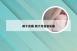四个月癣 四个月宝宝长藓