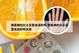 银屑病吃红小豆薏米汤好吗 银屑病吃红小豆薏米汤好吗女性