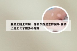 胳膊上腿上有癣一样的东西是怎样回事 胳膊上腿上长了很多小疙瘩