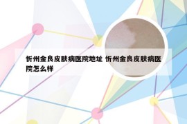 忻州金良皮肤病医院地址 忻州金良皮肤病医院怎么样