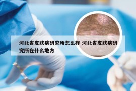 河北省皮肤病研究所怎么样 河北省皮肤病研究所在什么地方