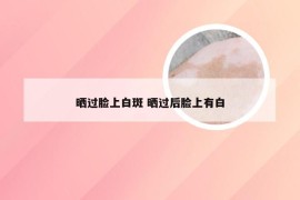 晒过脸上白斑 晒过后脸上有白