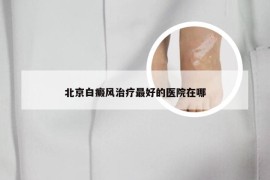 北京白癜风治疗最好的医院在哪