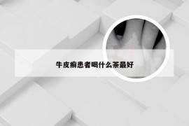 牛皮癣患者喝什么茶最好