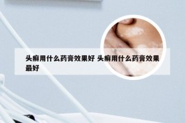 头癣用什么药膏效果好 头癣用什么药膏效果最好
