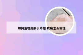 如何治理皮癣小妙招 皮癣怎么调理