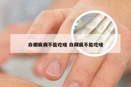 白癫疯病不能吃啥 白颠疯不能吃啥