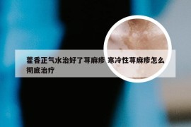 藿香正气水治好了荨麻疹 寒冷性荨麻疹怎么彻底治疗