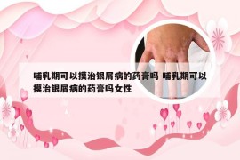 哺乳期可以摸治银屑病的药膏吗 哺乳期可以摸治银屑病的药膏吗女性