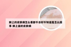 脚上的皮肤病怎么看都不会好不知道是怎么回事 脚上面的皮肤病