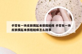 手臂有一块皮肤摸起来很粗糙痒 手臂有一块皮肤摸起来很粗糙痒怎么回事