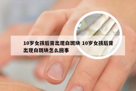 10岁女孩后背出现白斑块 10岁女孩后背出现白斑块怎么回事