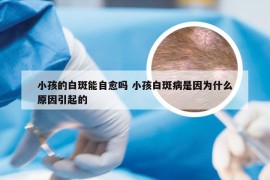 小孩的白斑能自愈吗 小孩白斑病是因为什么原因引起的