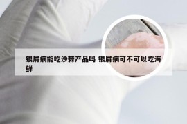 银屑病能吃沙棘产品吗 银屑病可不可以吃海鲜