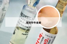 宋庆玲牛皮癣