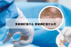 紫椒癣酊是什么 紫椒癣酊是什么药