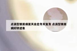 点滴型银屑病夏天自愈冬天复发 点滴型银屑病好转迹象