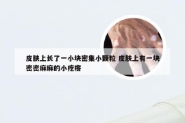 皮肤上长了一小块密集小颗粒 皮肤上有一块密密麻麻的小疙瘩