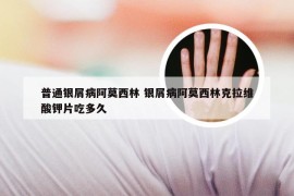普通银屑病阿莫西林 银屑病阿莫西林克拉维酸钾片吃多久