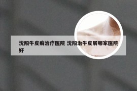 沈阳牛皮癣治疗医院 沈阳治牛皮屑哪家医院好
