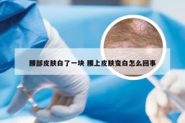 腰部皮肤白了一块 腰上皮肤变白怎么回事