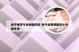 南宁哪家牛皮癣医院好 南宁皮肤病医院十大排名榜