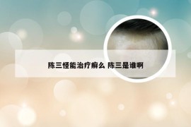 陈三怪能治疗癣么 陈三是谁啊