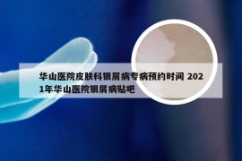 华山医院皮肤科银屑病专病预约时间 2021年华山医院银屑病贴吧
