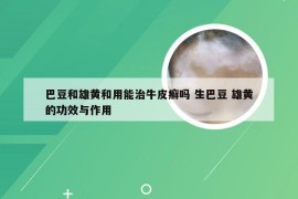 巴豆和雄黄和用能治牛皮癣吗 生巴豆 雄黄的功效与作用
