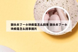 额头长了一小块癣是怎么回事 额头长了一小块癣是怎么回事图片