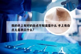 我的手上有好的白点不知道是什么 手上有白点儿是表示什么?