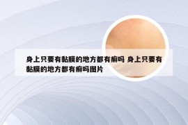 身上只要有黏膜的地方都有癣吗 身上只要有黏膜的地方都有癣吗图片