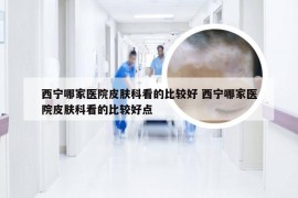 西宁哪家医院皮肤科看的比较好 西宁哪家医院皮肤科看的比较好点