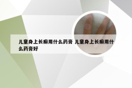 儿童身上长癣用什么药膏 儿童身上长癣用什么药膏好
