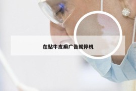 在贴牛皮癣广告就停机
