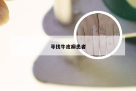 寻找牛皮癣患者