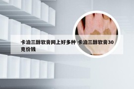 卡泊三醇软膏网上好多种 卡泊三醇软膏30克价钱
