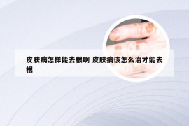 皮肤病怎样能去根啊 皮肤病该怎么治才能去根