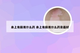 身上有藓用什么药 身上有藓用什么药膏最好