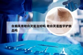 白癜风用敏白灵能治好吗 敏白灵是医学护肤品吗