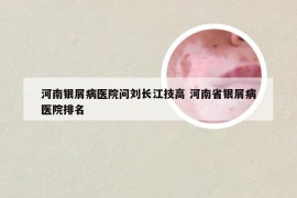 河南银屑病医院问刘长江技高 河南省银屑病医院排名