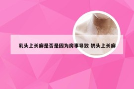 乳头上长癣是否是因为房事导致 奶头上长癣