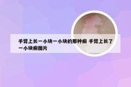 手臂上长一小块一小块的那种癣 手臂上长了一小块癣图片
