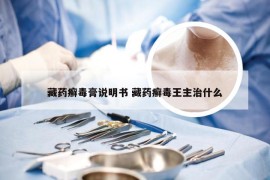 藏药癣毒膏说明书 藏药癣毒王主治什么