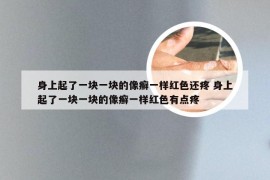 身上起了一块一块的像癣一样红色还疼 身上起了一块一块的像癣一样红色有点疼
