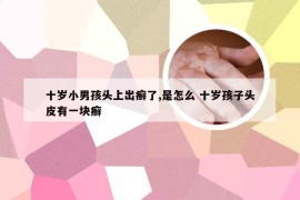 十岁小男孩头上出癣了,是怎么 十岁孩子头皮有一块癣