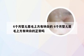 6个月婴儿眉毛上方有块白的 6个月婴儿眉毛上方有块白的正常吗