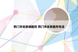 荆门市皮肤病医院 荆门市皮肤医院电话